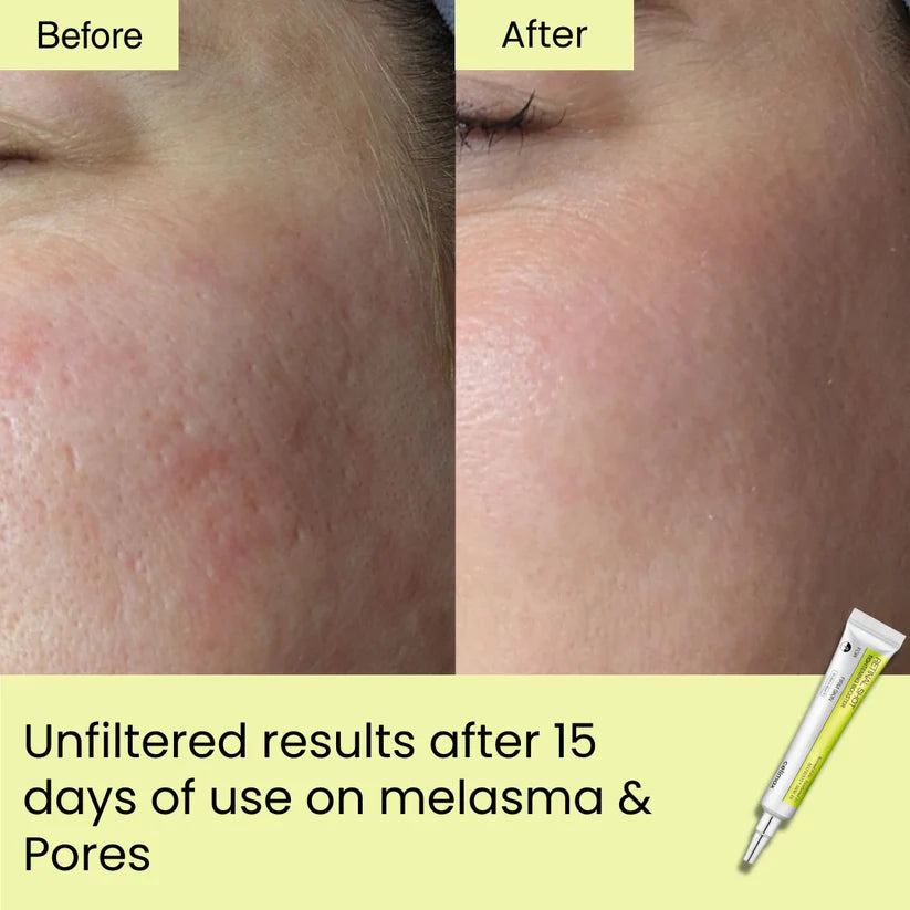 Seoul Beauty Zone Retinal Shot Tightening Booster