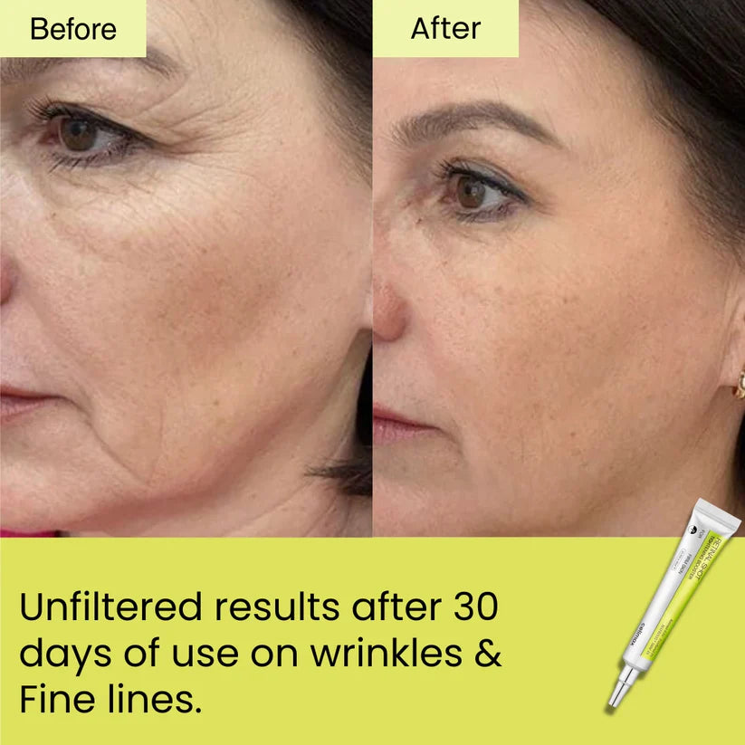 Seoul Beauty Zone Retinal Shot Tightening Booster