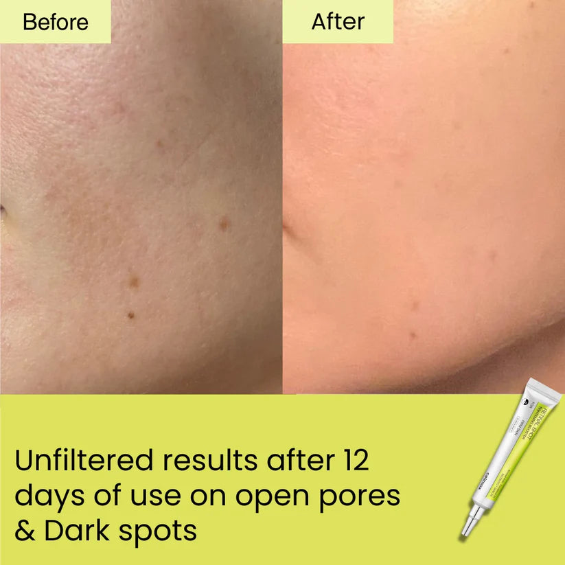 Seoul Beauty Zone Retinal Shot Tightening Booster