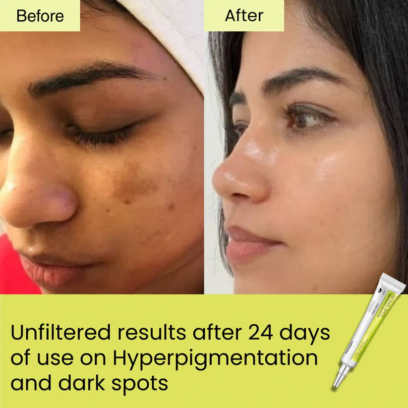 Seoul Beauty Zone Retinal Shot Tightening Booster