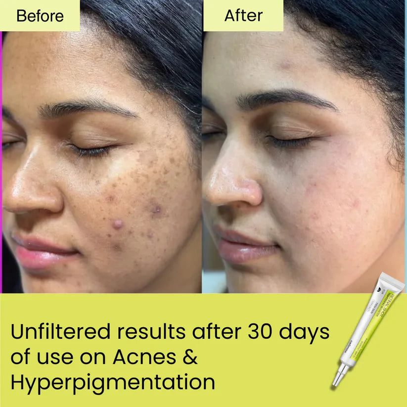 Seoul Beauty Zone Retinal Shot Tightening Booster