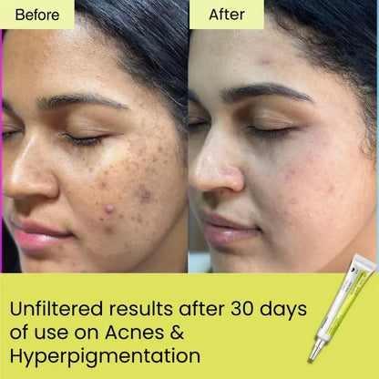 Seoul Beauty Zone Retinal Shot Tightening Booster